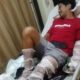 Seorang Pria Banyuwangi Terluka Parah Akibat Petasan yang Dirakitnya Meledak (foto: baliexpress)