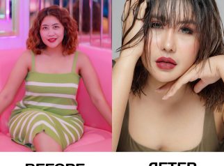 transformasi Aprilia Sky usai menjalani operasi kecantikan