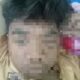 Korban kasus Bullying di SMPN 4 Banyuwangi