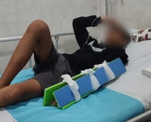 Kronologi Siswa SMP Negeri 4 Banyuwangi Dianiaya Teman Satu Sekolahnya
