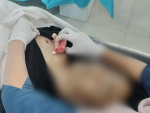 Seorang Pelajar yang Tewas Tertembak, Saat ini Diotopsi di RS Bhayangkara