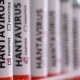 Hantavirus Bukan Penyakit Baru