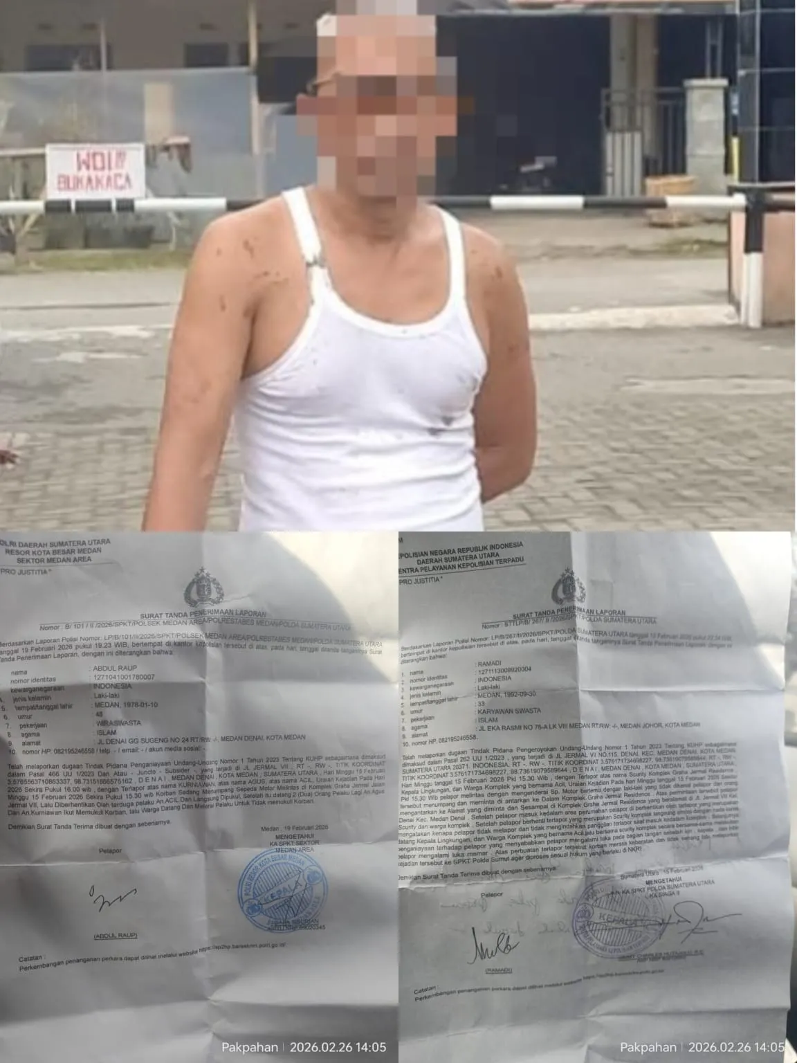 Korban Dugaan Penganiayaan di Medan Minta Kepastian Hukum
