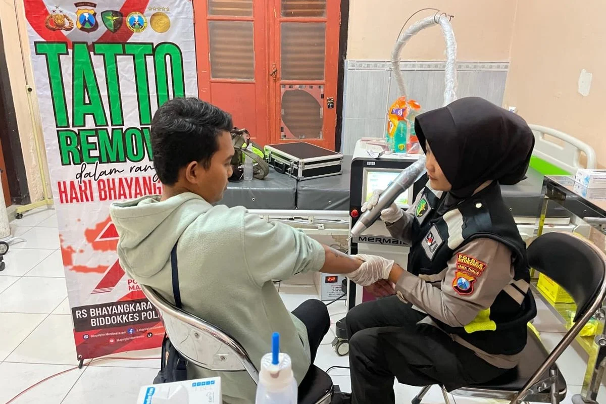 Polres Situbondo Gelar Bakti Sosial Donor Darah dan Hapus Tato Gratis