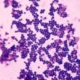 Bakteri Staphylococcus Aureus Ditemukan di Menu MBG, Pengawasan Dapur Diperketat