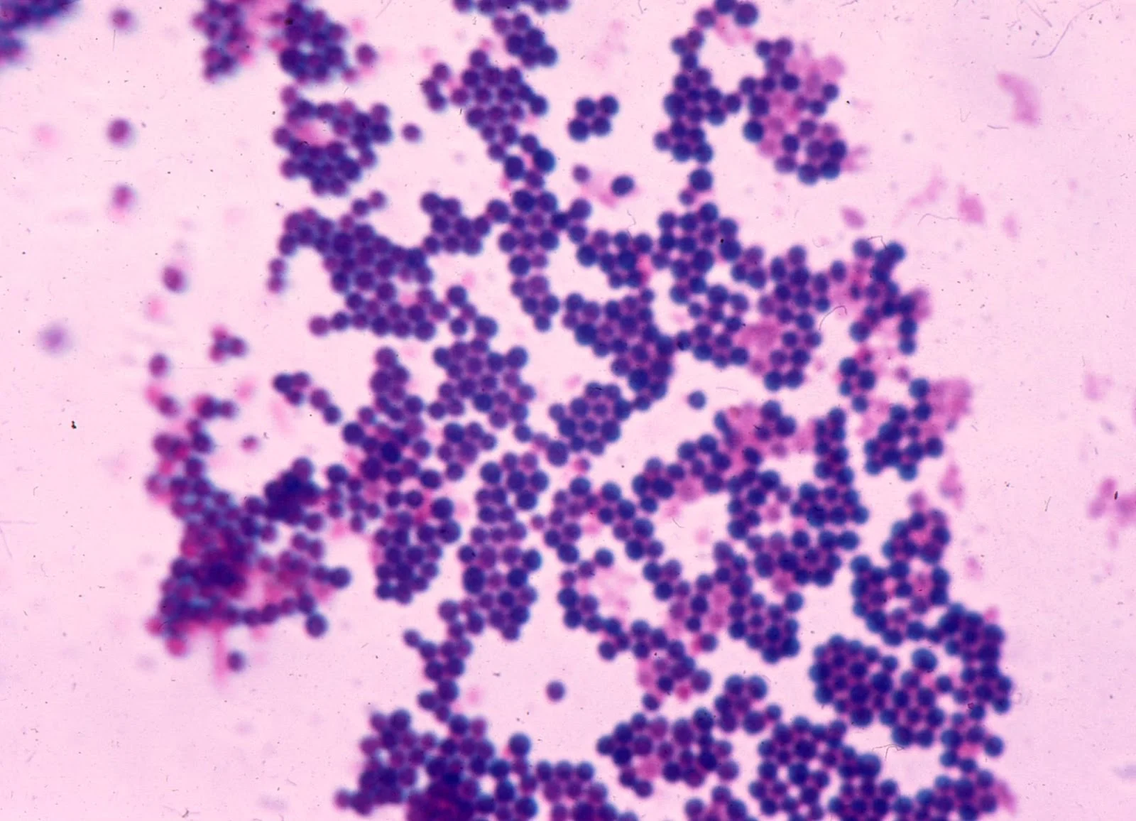 Bakteri Staphylococcus Aureus Ditemukan di Menu MBG, Pengawasan Dapur Diperketat