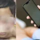 Sering Main Gadget Tidak Langsung Sebabkan Mata Anak Juling, Ini Penjelasan Dokter