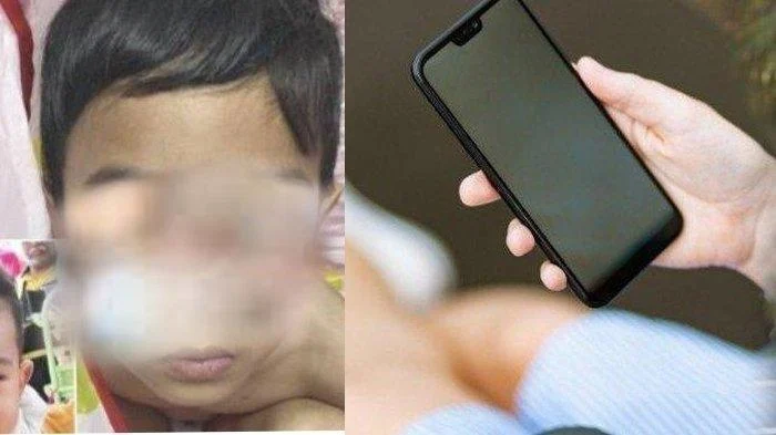 Sering Main Gadget Tidak Langsung Sebabkan Mata Anak Juling, Ini Penjelasan Dokter