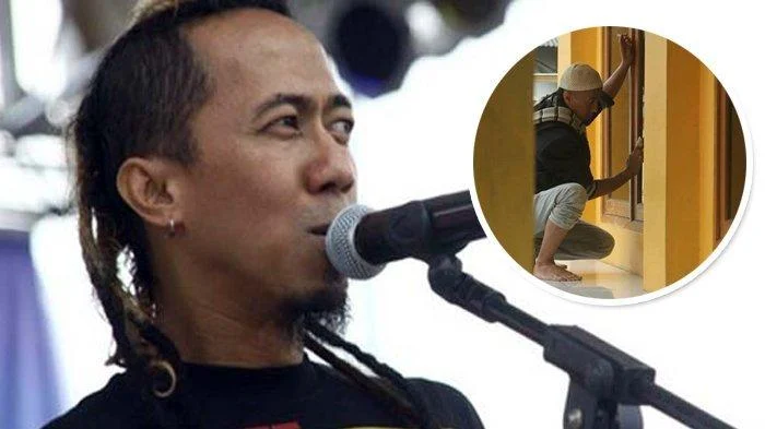 Vokalis Pas Band Yukie Alami Kecelakaan di Bandung, Kepala Harus Dijahit 10 Jahitan Akibat Microsleep Pengemudi