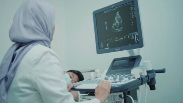 Poliklinik Jantung RSUD Kota Serang Hadirkan Layanan Pemeriksaan dan Konsultasi Jantung