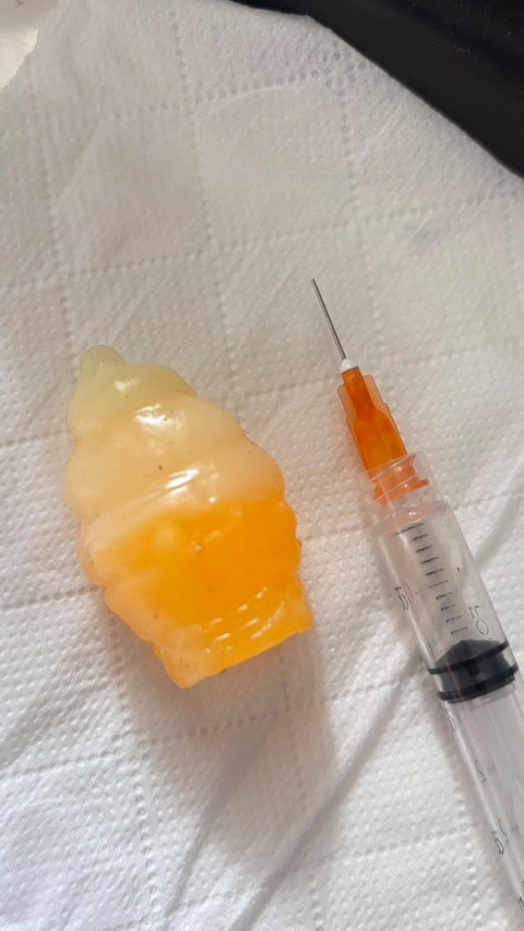Waka Komisi IX Minta Orang Tua dan Sekolah Waspadai Squishy Berjarum